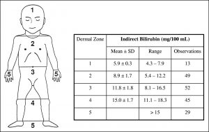 تشخیص زردی نوزادان