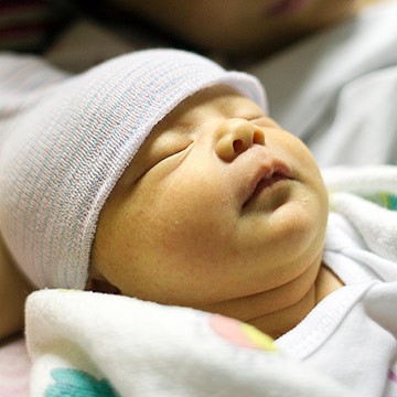 پرتو نوزاد پارس | درمان زردی با روش حجامت نوزادان