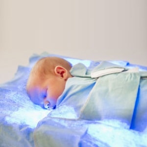 پرتو نوزاد پارس | اختراع لباس فتوتراپي نوزاد توسط آقای دکتر صالحی