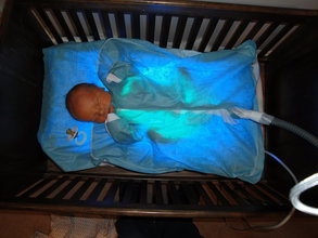 پرتو نوزاد پارس | پتوی فتوتراپی