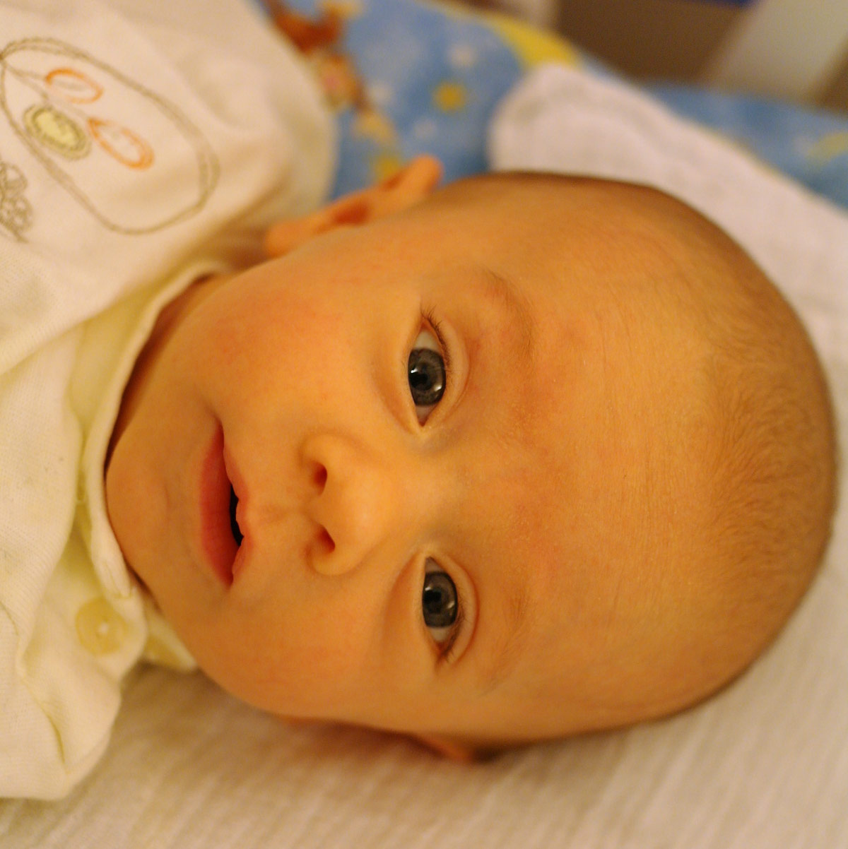 Желтуха у доношенного новорожденного. Желтушка у новорожденного. Физиологическая желтушка у новорожденных. Что такое желтушка у новорожденных детей. Неонатальная желтушка у новорожденного.